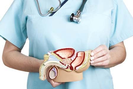 макет мочеполовой системы мужчины в руках у доктора