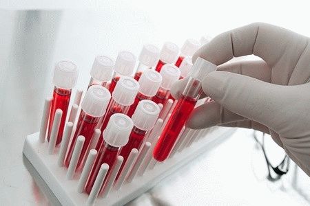 Нормы и отклонение общего анализа крови на простатический специфический антиген (ПСА) при простатите