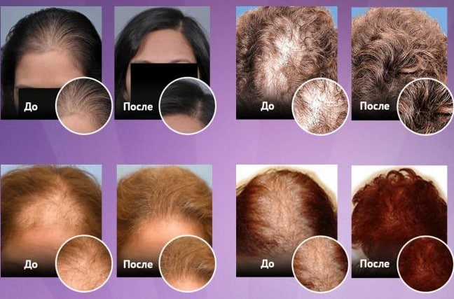 Спрей shevelux для роста и восстановления волос thumbnail
